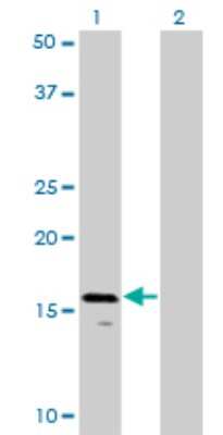 Western Blot: AGTRAP Antibody (1G2) [H00057085-M02]