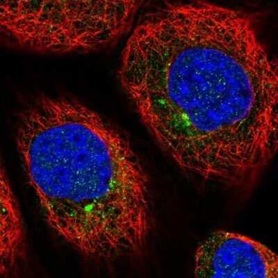 Immunocytochemistry/ Immunofluorescence: AGTRAP Antibody [NBP1-91654]