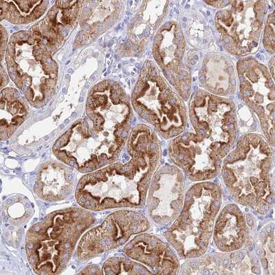 Immunohistochemistry-Paraffin: AGTRAP Antibody [NBP1-91654]