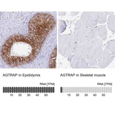 Immunohistochemistry-Paraffin: AGTRAP Antibody [NBP1-91654]