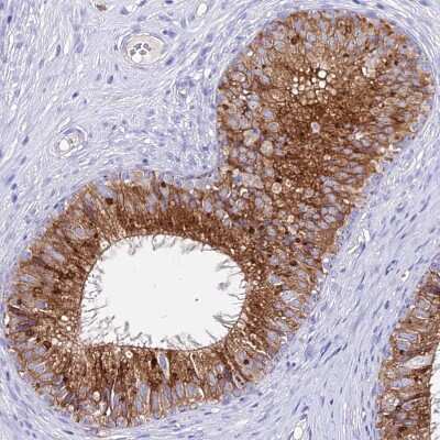 Immunohistochemistry-Paraffin: AGTRAP Antibody [NBP1-91654]