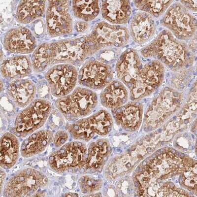 Immunohistochemistry-Paraffin: AGTRAP Antibody [NBP1-91654]