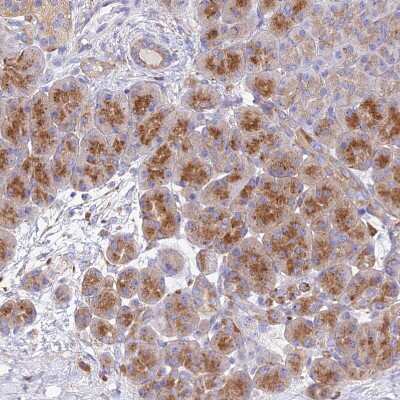 Immunohistochemistry-Paraffin: AGTRAP Antibody [NBP1-91654]