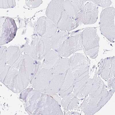 Immunohistochemistry-Paraffin: AGTRAP Antibody [NBP1-91654]