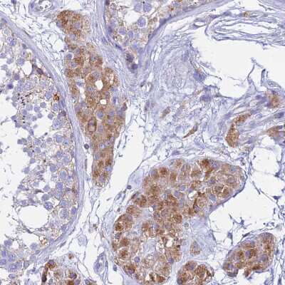 Immunohistochemistry-Paraffin: AGTRAP Antibody [NBP1-91654]