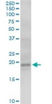 Western Blot: AGTRAP Antibody [H00057085-B01P]