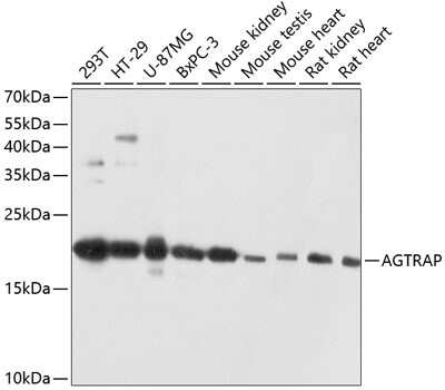 Western Blot: AGTRAP AntibodyAzide and BSA Free [NBP2-92060]