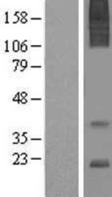 Western Blot: AGTRAP Overexpression Lysate [NBL1-07399]