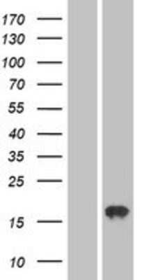 Western Blot: AGTRAP Overexpression Lysate [NBP2-04378]