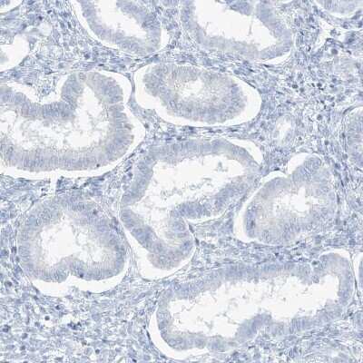 Immunohistochemistry-Paraffin: AGXT Antibody [NBP1-89200]