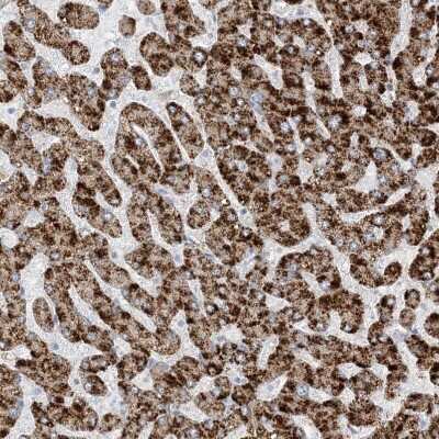 Immunohistochemistry-Paraffin: AGXT Antibody [NBP1-89200]