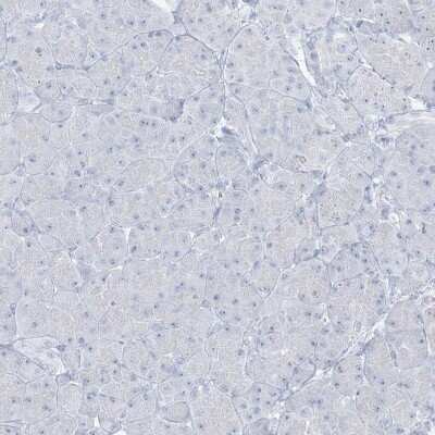 Immunohistochemistry-Paraffin: AGXT Antibody [NBP1-89200]