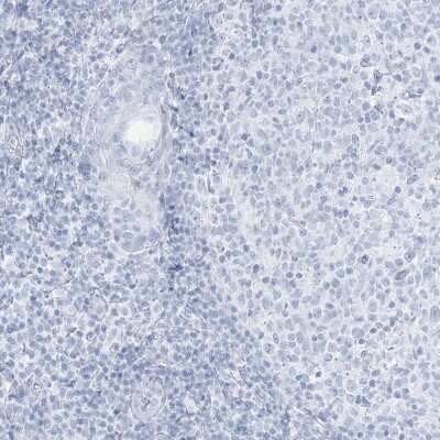 Immunohistochemistry-Paraffin: AGXT Antibody [NBP1-89200]