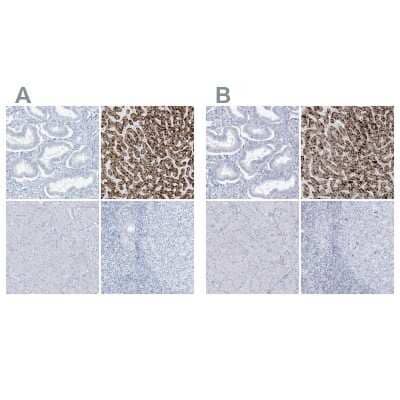 Immunohistochemistry-Paraffin: AGXT Antibody [NBP1-89200]
