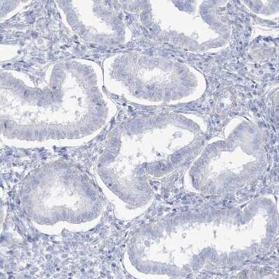 Immunohistochemistry-Paraffin: AGXT Antibody [NBP2-34198]