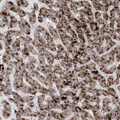 Immunohistochemistry-Paraffin: AGXT Antibody [NBP2-34198]