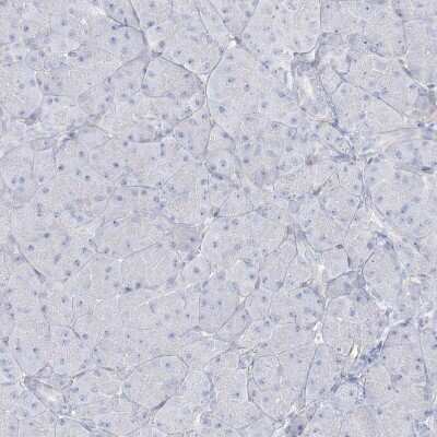 Immunohistochemistry-Paraffin: AGXT Antibody [NBP2-34198]