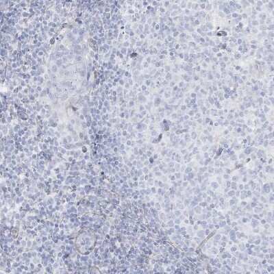 Immunohistochemistry-Paraffin: AGXT Antibody [NBP2-34198]