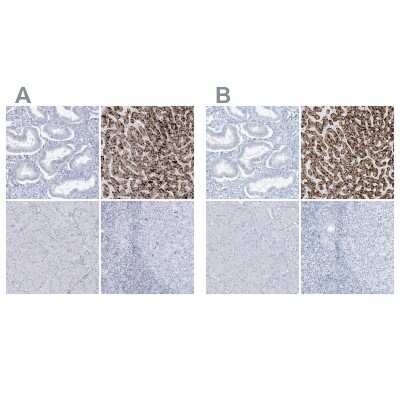 Immunohistochemistry-Paraffin: AGXT Antibody [NBP2-34198]