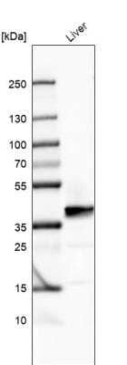 Western Blot: AGXT Antibody [NBP1-89200]