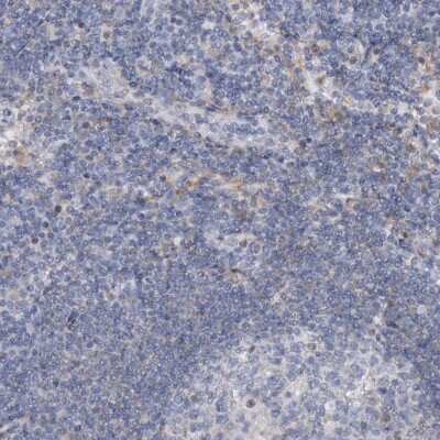Immunohistochemistry-Paraffin: AGXT2 Antibody [NBP1-89199]