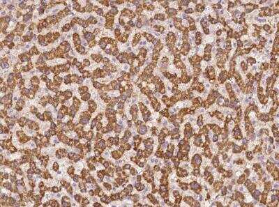 Immunohistochemistry-Paraffin: AGXT2 Antibody [NBP3-06037]