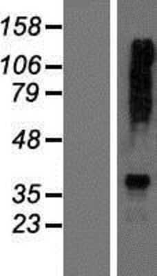 Western Blot: AGXT2 Overexpression Lysate [NBP2-06106]