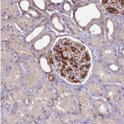Immunohistochemistry-Paraffin: AGXT2L1 Antibody [NBP1-91655]