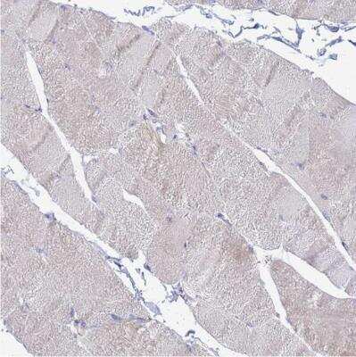 Immunohistochemistry-Paraffin: AGXT2L1 Antibody [NBP1-91655]
