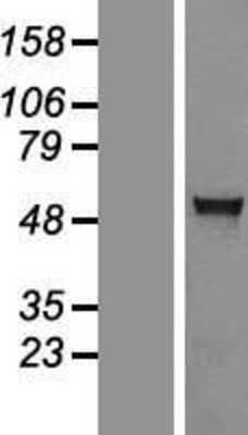 Western Blot: AGXT2L1 Overexpression Lysate [NBL1-07400]