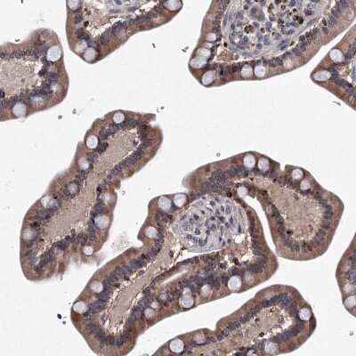 Immunohistochemistry-Paraffin: AGXT2L2 Antibody [NBP1-81190]