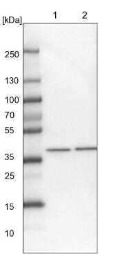 Western Blot: AGXT2L2 Antibody [NBP1-81190]