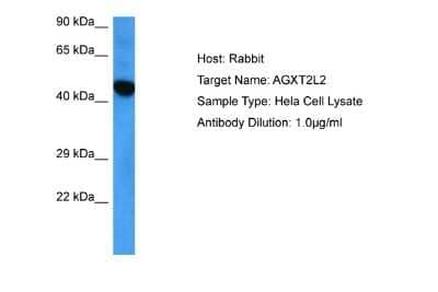 Western Blot: AGXT2L2 Antibody [NBP2-86967]