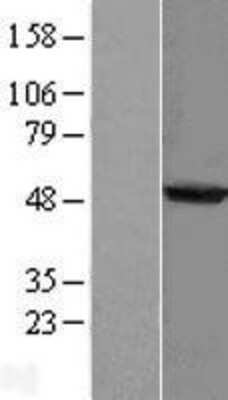 Western Blot: AGXT2L2 Overexpression Lysate [NBL1-07401]