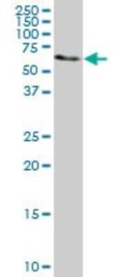 Western Blot: AHCYL1 Antibody (1B3) [H00010768-M03]