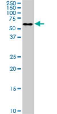 Western Blot: AHCYL1 Antibody (1B3) [H00010768-M03]