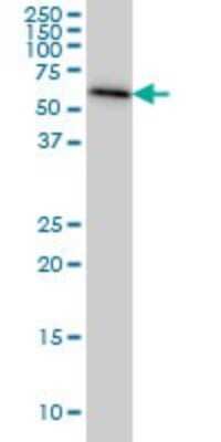 Western Blot: AHCYL1 Antibody (5D6) [H00010768-M05]