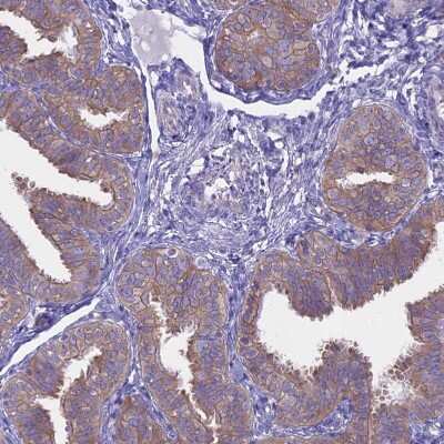 Immunohistochemistry: AHCYL1 Antibody [NBP1-83093]