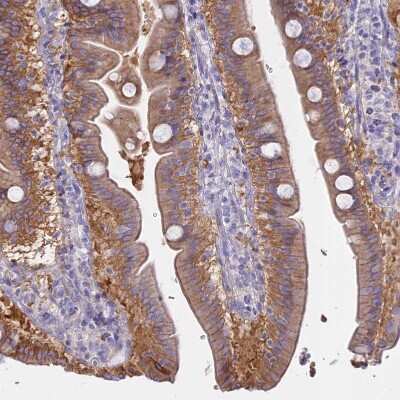 Immunohistochemistry-Paraffin: AHCYL1 Antibody [NBP1-83093]