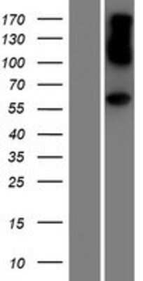 Western Blot: AHCYL1 Overexpression Lysate [NBP2-07599]