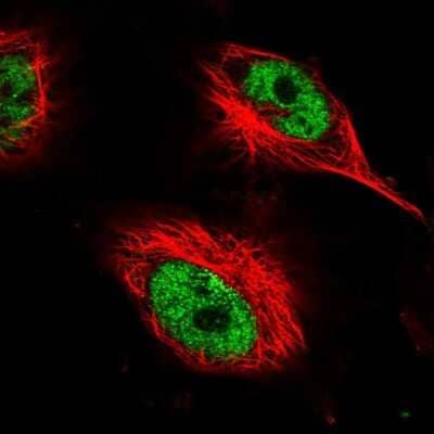 Immunocytochemistry/ Immunofluorescence: AHDC1 Antibody [NBP1-84238]