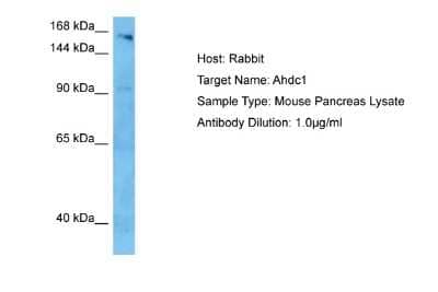 Western Blot: AHDC1 Antibody [NBP2-84409]