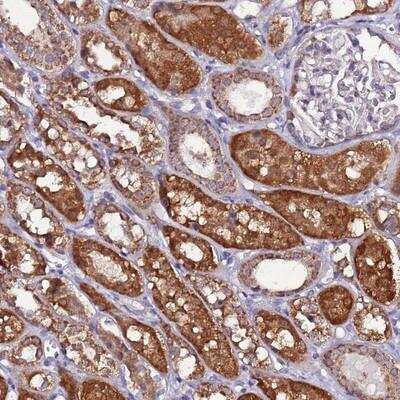 Immunohistochemistry-Paraffin: AHI1 Antibody [NBP2-14274]