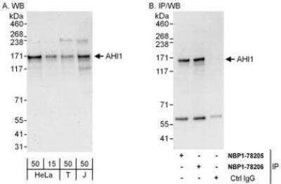 Western Blot: AHI1 Antibody [NBP1-78206]