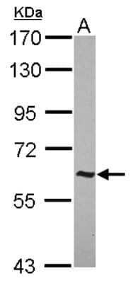 Western Blot: AHI1 Antibody [NBP2-15309]