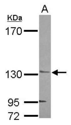 Western Blot: AHI1 Antibody [NBP2-15310]