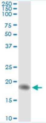 Immunoprecipitation: AHNAK Antibody (3G7) [H00079026-M01]