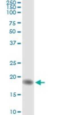 Immunoprecipitation: AHNAK Antibody (3G7) [H00079026-M01]