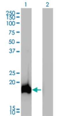 Western Blot: AHNAK Antibody (3G7) [H00079026-M01]