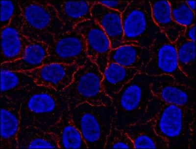 Immunocytochemistry/ Immunofluorescence: AHNAK Antibody (EM-09) [NBP2-62204]